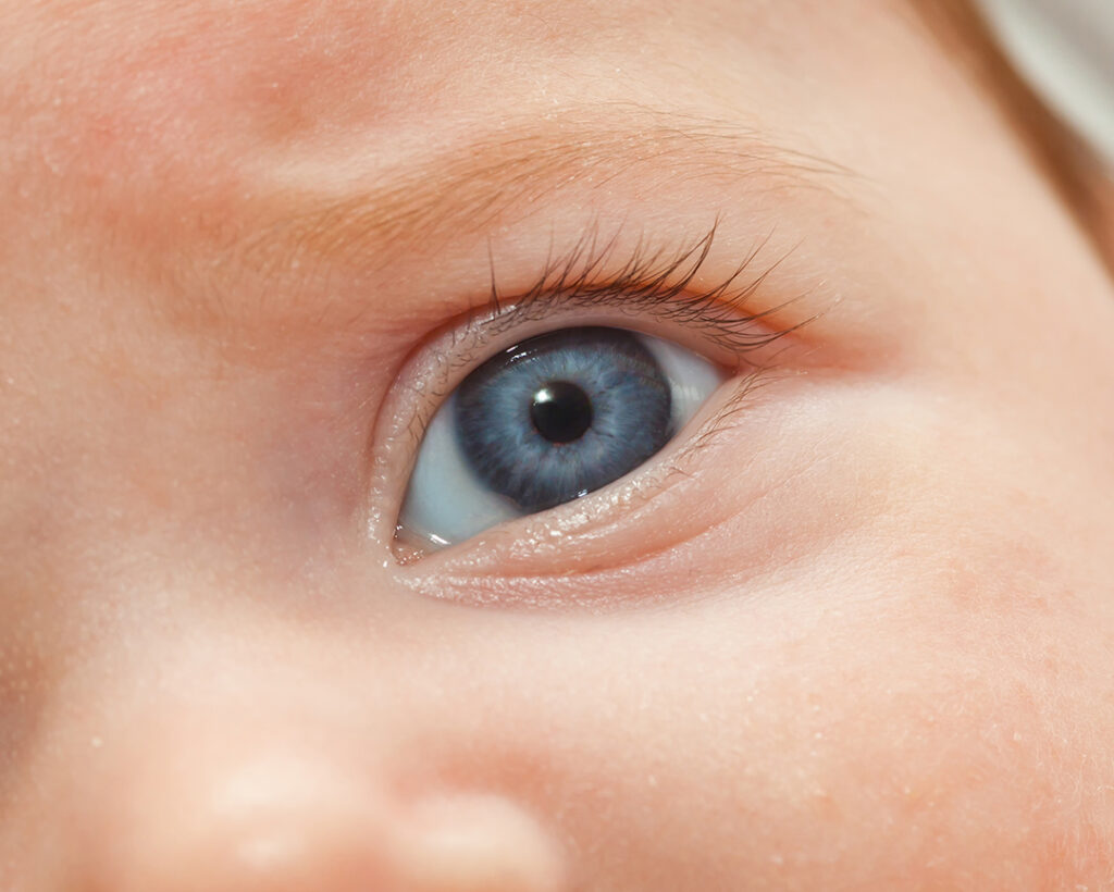 Baby's eyes are having trouble tracking objects